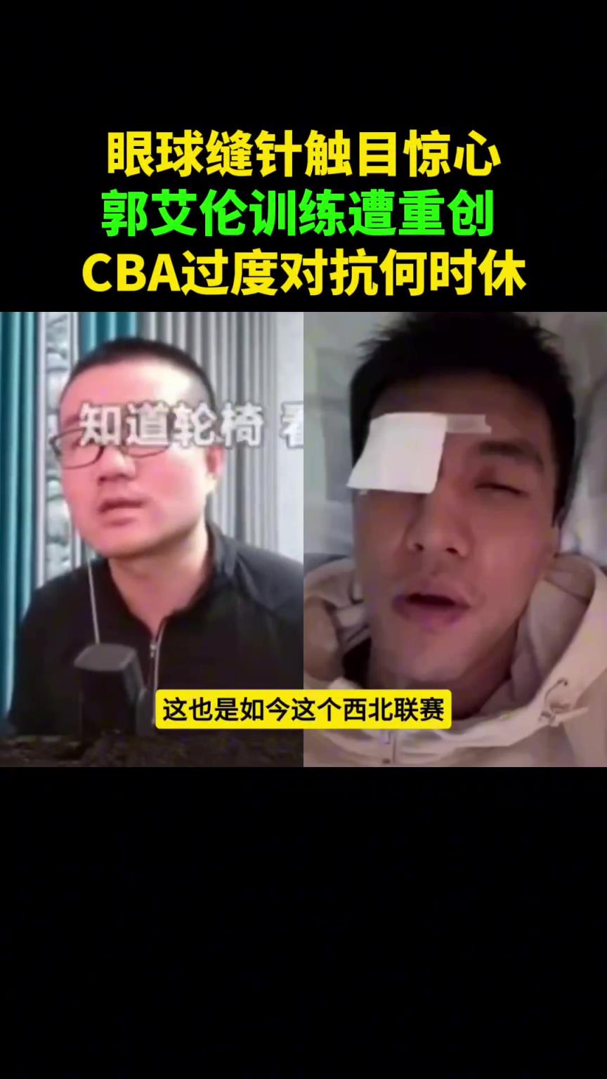 徐静雨谈郭艾伦受伤：怪CBA一味强调身体对抗 动作越猛越受鼓励